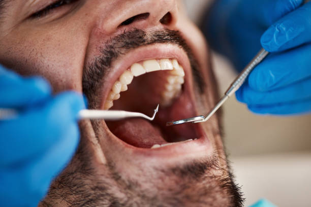 Best Broken or Chipped Tooth Repair in Searles Valley, CA